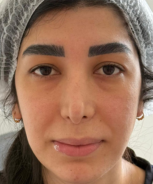 قبل
